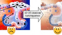 СОЛЯНАЯ КОМНАТА